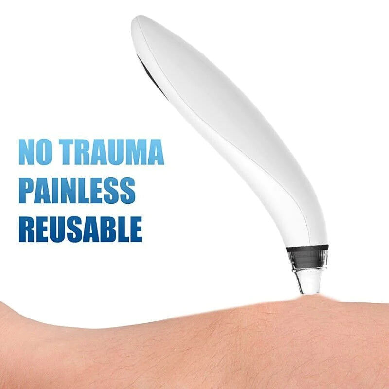 Electric Blackhead Remover 