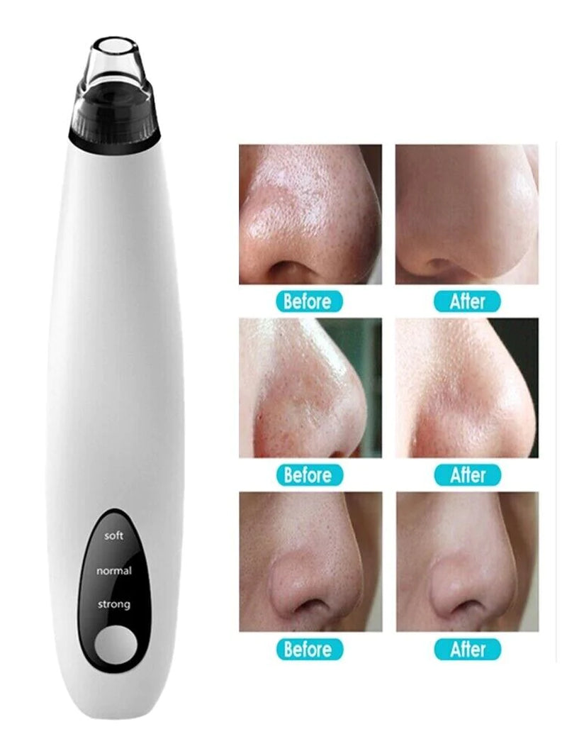 Electric Blackhead Remover 